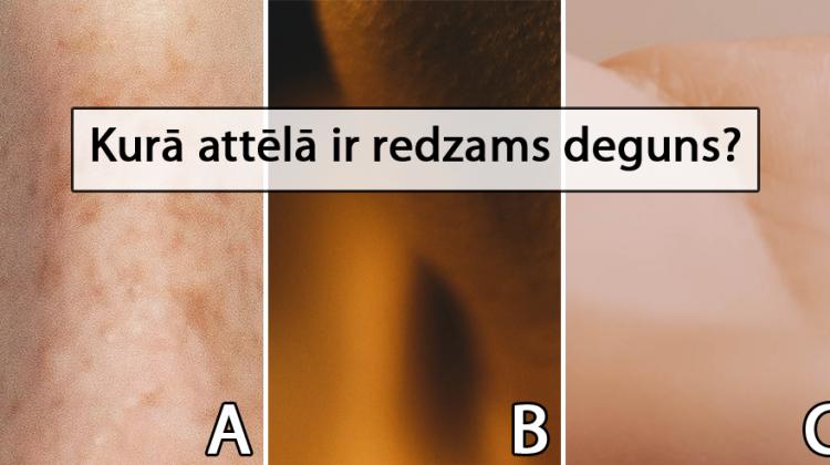 Tests: Vai vari atpazīt ķermeņa daļu, ja redzi tikai daļu no tās?