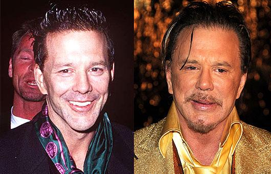 Mickey Rourke atzinis ka ir... Autors: UglyPrince Plastiskā ķirurģija