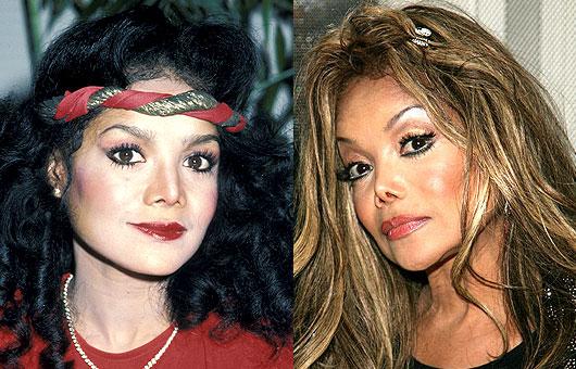 LaToya Jackson deguna... Autors: UglyPrince Plastiskā ķirurģija