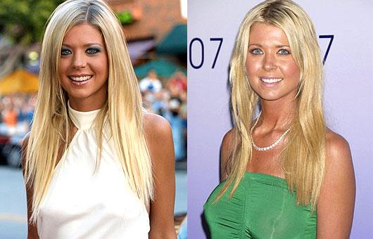 Tara Reid atzīst ka veikusi... Autors: UglyPrince Plastiskā ķirurģija