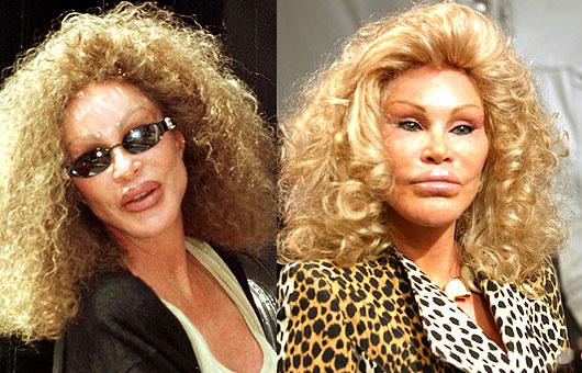 Jocelyn Wildenstein vaigu... Autors: UglyPrince Plastiskā ķirurģija