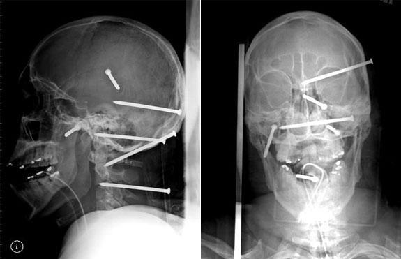 Šajā rentgenuzņēmumā redzams... Autors: UglyPrince Ko rāda rentgens?