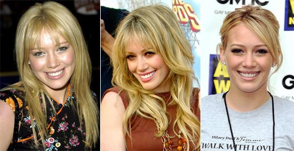 Hilary Duff nevar lepoties ar... Autors: UglyPrince Slevenību Zobi