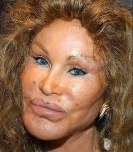 1 Jocelyn Wildenstein dēvē arī... Autors: Princesse 10 neglītākās slavenības.