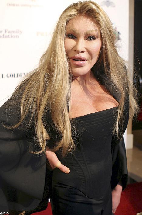  Autors: mazakuce Jocelyn Wildenstein