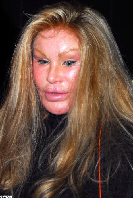  Autors: mazakuce Jocelyn Wildenstein