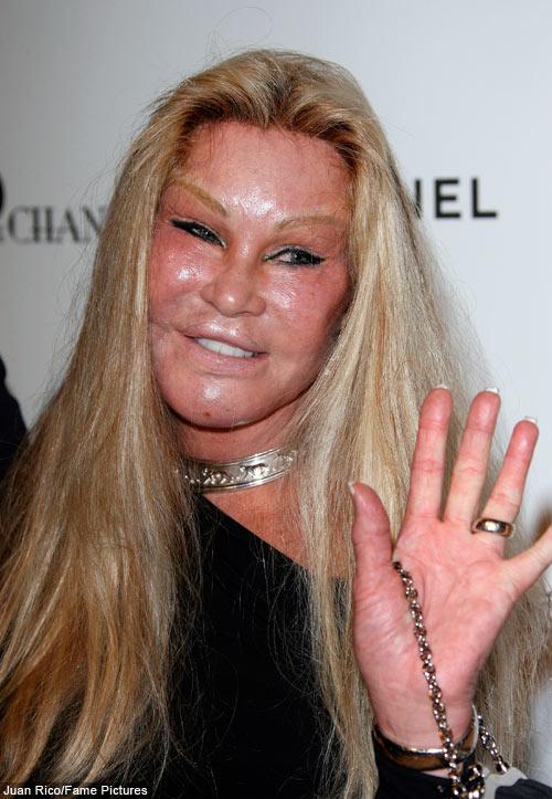 2009 septembris Autors: mazakuce Jocelyn Wildenstein