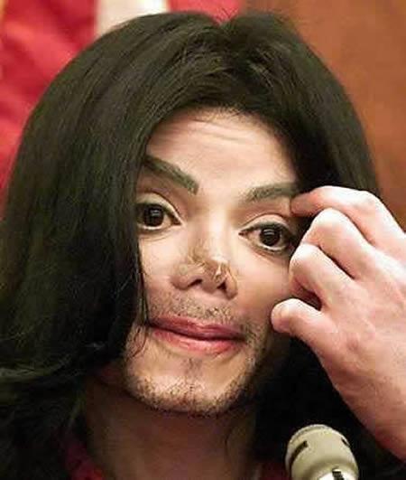 Michael Jackson  vairāk nekā... Autors: ruutel Plastiskās operācijas