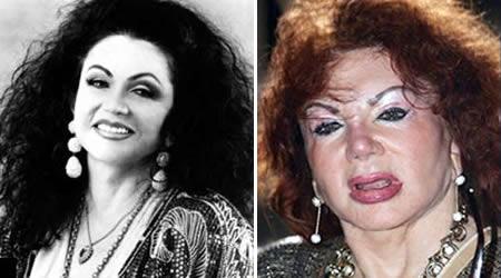 Jackie Stallone  Jā visu... Autors: ruutel Plastiskās operācijas