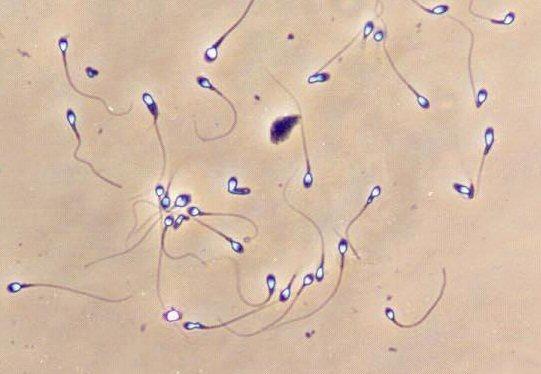 Neizmantotos spermatozoīdus... Autors: Moonwalker Fakti par reproduktīvo sistēmu