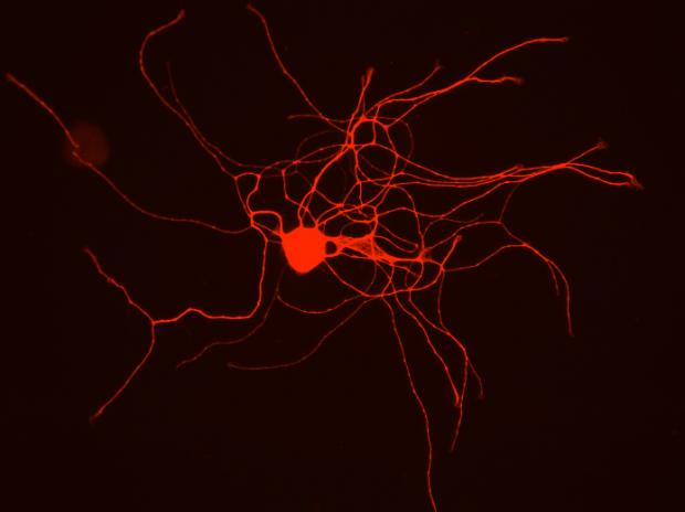 Neironi pilda 5 f  cijas ... Autors: Raitons skeletons Iz zinātnes