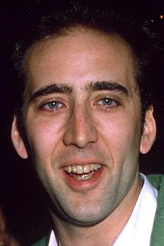 Nicolas Cage 90ajos Nikolasa... Autors: agii91 Slavenību zobi. Pirms un pēc.