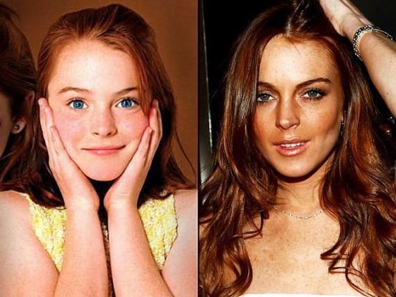 Lindsay Lohan Autors: GoodMorningStarshine 45 Slavenības Toreiz vs. Tagad.