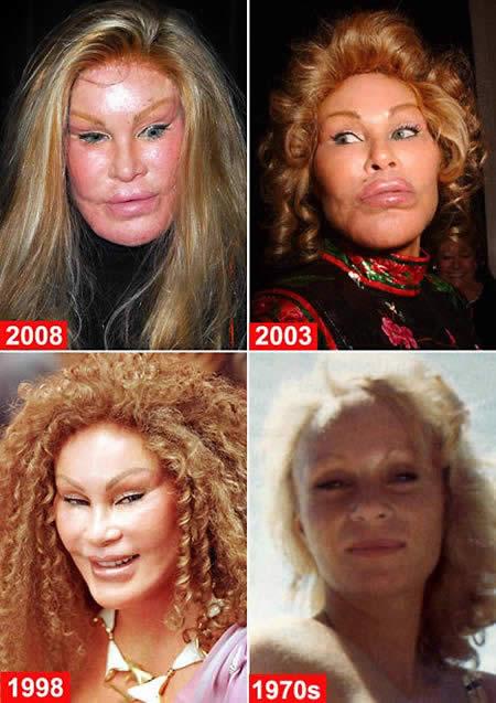 Jocelyn Wildenstein viņas seja... Autors: una puna 10 sliktākās plastiskās operācijas