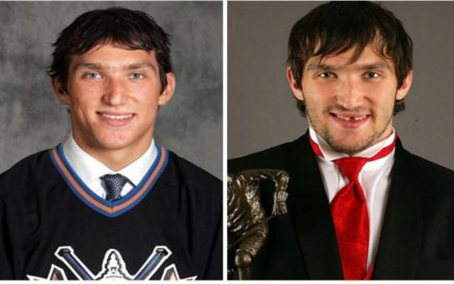 Alexander Ovechkin hokejists... Autors: King Ring Večiem zobus nevajag!