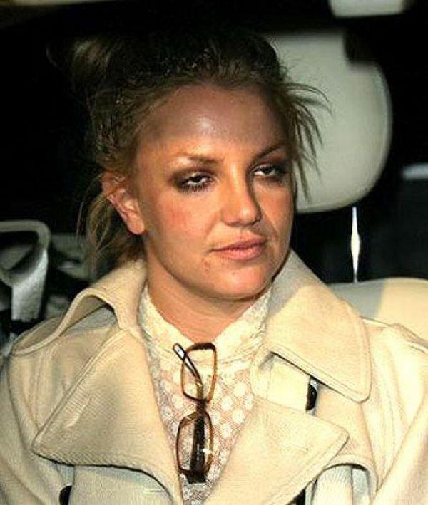 Britney Spears Autors: Vladziks 10 neglītākie slavenību foto