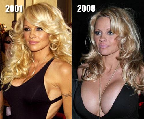 Pamela Anderson Autors: moodway Pirms Un Pēc