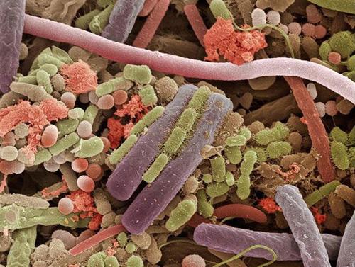 Baktērijas kas dzīvo uz... Autors: Tiamo Zem mikroskopa