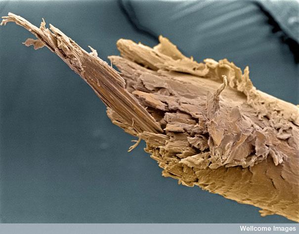 Cilvēka matu beigas Autors: Geimeris Skatoties ar pasaulē labāko mikroskopu [1]