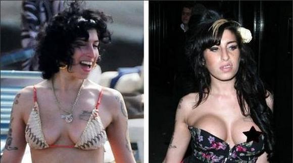 Amy Winehouse Šeit jēga ir... Autors: burnenergy Plastiskās operācijas