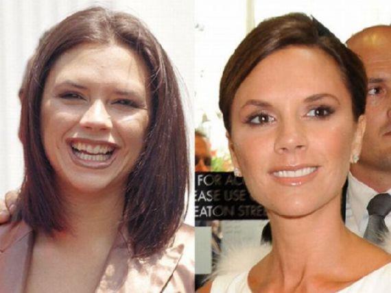 Victoria Beckham Autors: MJ Slavenību zobi pirms un pēc!