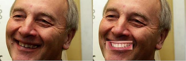 Bērziņš Autors: MJ Slavenību zobi pirms un pēc!
