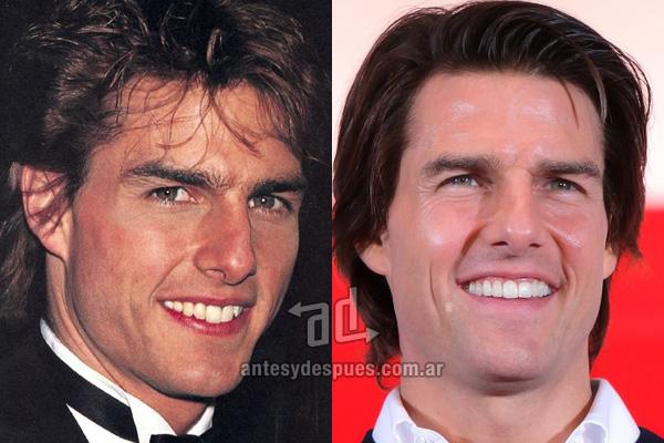 Tom Cruise Autors: iikssa Holivudas smaids