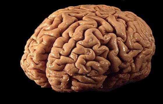Smadzeņu platums ir 140mm... Autors: rasty Pilnīgi bezjēdzīgi fakti TEV!!!