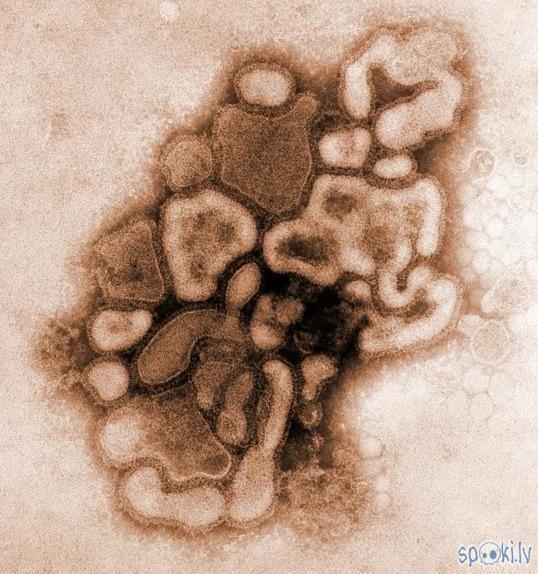 Autors: Le Bagman H1N1 Vīruss (Tautā sauktā cūku gripa)