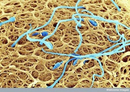 Sperma uz olscaronūnas virsmas Autors: Karapietka Cilvēks zem mikroskopa.
