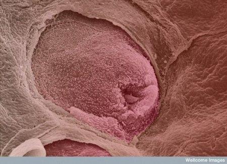 Garscaronas kārpiņas uz mēles Autors: Karapietka Cilvēks zem mikroskopa.