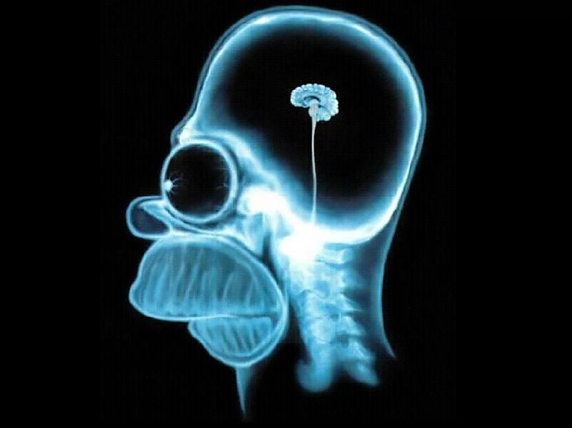  Autors: Keip Kam ir vislielākās smadzenes?