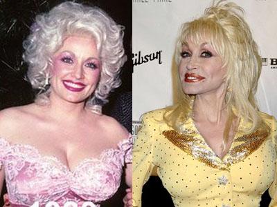 Dolly Partonman sķiet viņa... Autors: Fosilija 20 slavenības ar slikto plastisko ķirurģiju