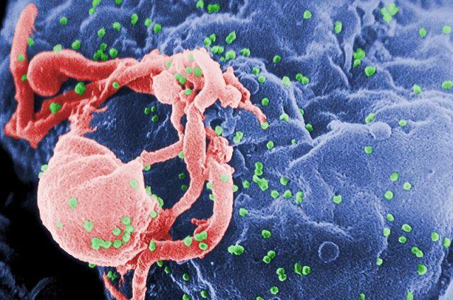 HIV vīrus iekrāsots zaļā krāsā Autors: vaera 1. decembris AIDS diena