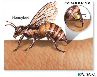 Palīdz bišu dzēlienu... Autors: wyatt Sāls noder daudzām lietām.