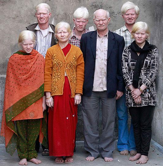 nbspViņiem bija jāpaciescaron... Autors: Administrācija Visa ģimene albīni