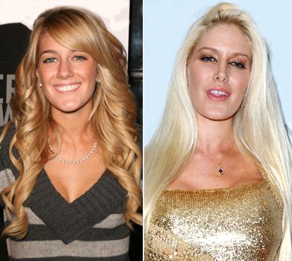 Heidi Montag Autors: Soldžijs Slavenību pārmaiņas .