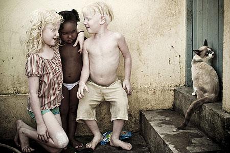 nbspnbspTāpat albīni bieži... Autors: SmallSmooker Melnādaino pāra ģimenē piedzimuši trīs albīni