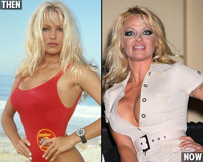 Pamela Anderson Nu kā tad bez... Autors: iFamous Tīņu zvaigznes Tad & Tagad.