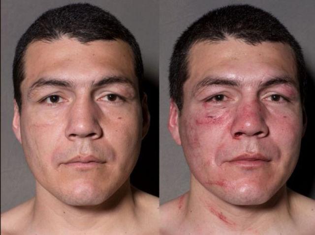  Autors: MJ Kā izskatās bokseru sejas pirms un pēc cīņas. Šokējoši FOTO