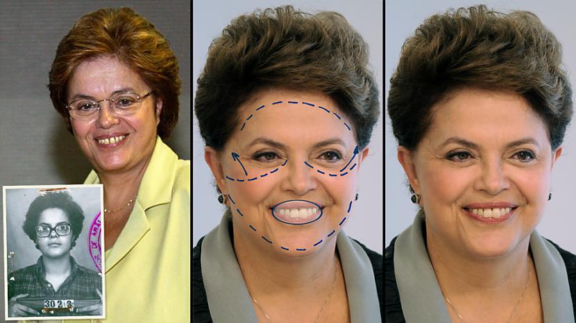 Brazīlijas prezidente Dilma... Autors: Raziels Politiķi  un plastiskā ķirurģija.