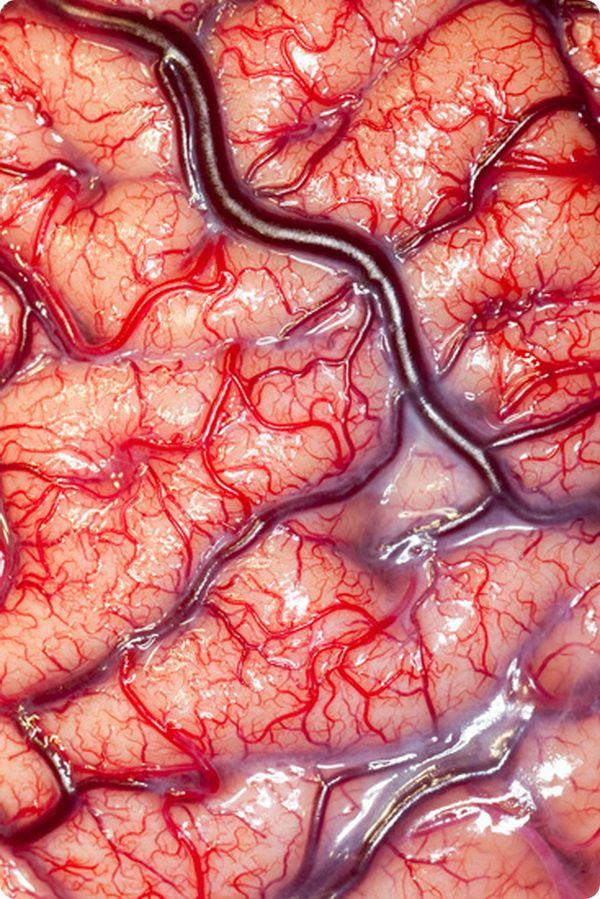 Dzīva cilvēka smadzeņu attēls... Autors: Moonwalker 20 unikāli zinātnes foto