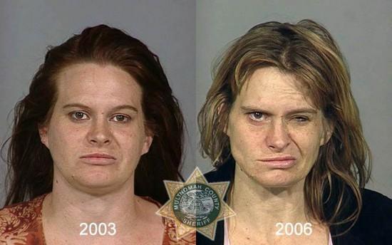  Autors: Fosilija Metamfetamīna lietotāji. Pirms un pēc.