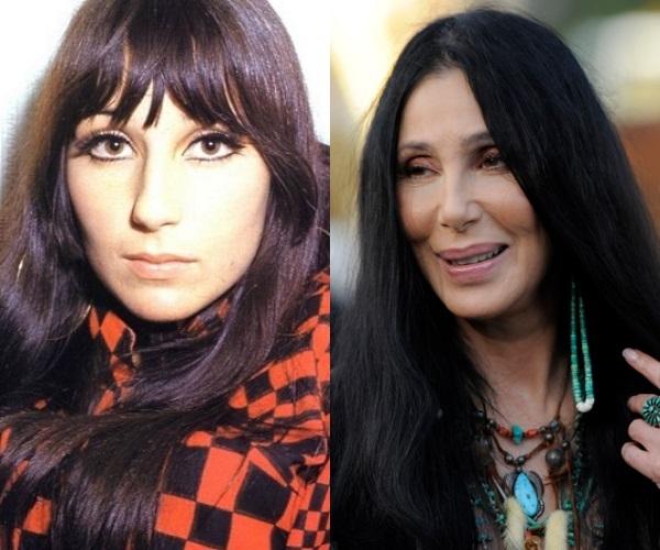 Cher Autors: spongebobRIP 10 slavenību izskati pirms un pēc plastiskās operācijas