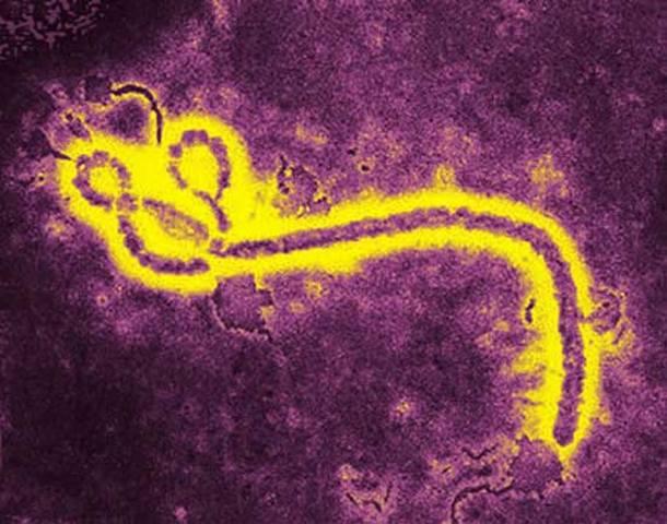 4InfekcijaHemorāģiskais Ebola... Autors: Raziels Kad zinātnieki ir pavirši