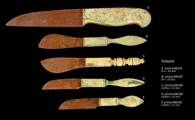 Bronzas skalpeļu kolekcija Autors: Budzisss Ķirurģija Senajā Romā