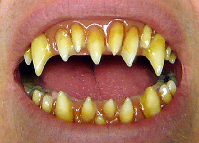 Dental Distortions morlockVisi... Autors: Raacens Ebay pērles /5/