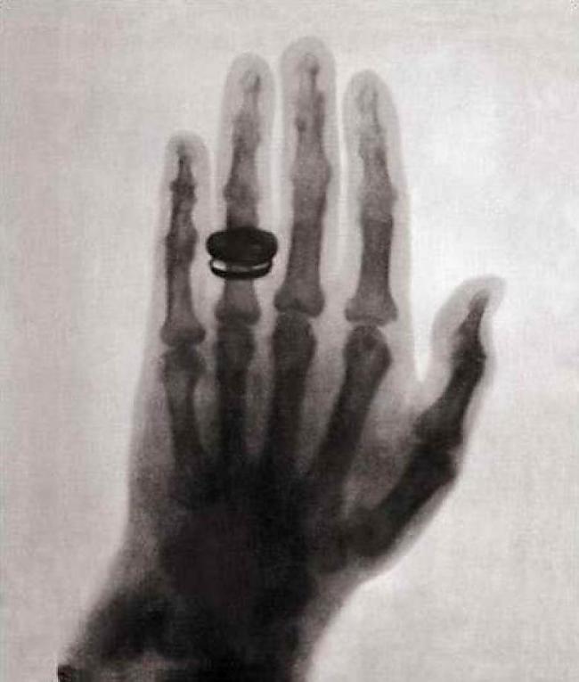 Pasaulē pirmais rentgens 1895... Autors: pofig Ikdienišķas lietas, kas Pasaulē bijušas pirmās!