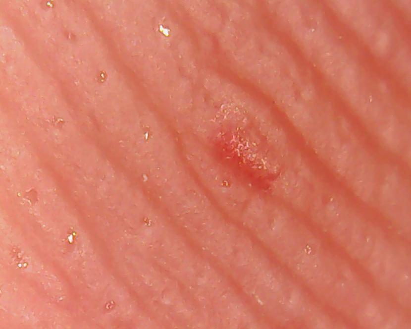 Rādītājpriksta āda ar tajā... Autors: Moonwalker USB mikroskops tavam datoram
