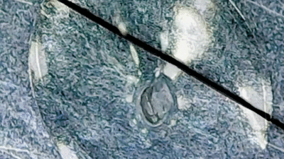Scaroneit ir redzams viens... Autors: Moonwalker Ikdienas priekšmeti manā mikroskopā 2. daļa